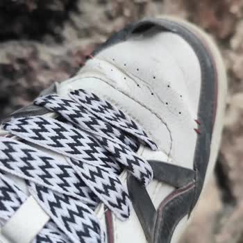 Garanti Kapsamındaki Ayakkabıda Yırtılma Ve Yaralanma, Mağaza Değişim Talebimi Reddetti