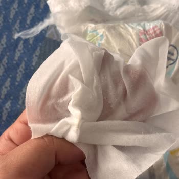 Molfix Külot Bezlerinde Polimer Sızıntısı Ve Bebek Cildi Tahrişi