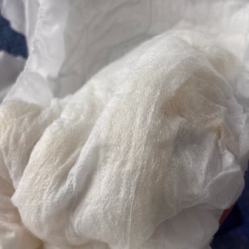 Molfix Külot Bezlerinde Polimer Sızıntısı Ve Bebek Cildi Tahrişi