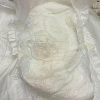 Molfix Bebek Bezinde Kullanılmış Görünen Lekeli Ürün