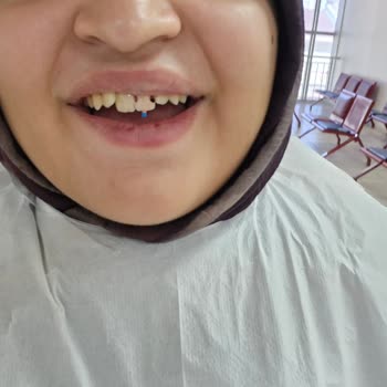 Mamak Ağız Ve Diş Hastanesinde Tedavi Sürecinin Aksaklığı Ve Yetersiz Ağrı Yönetimi