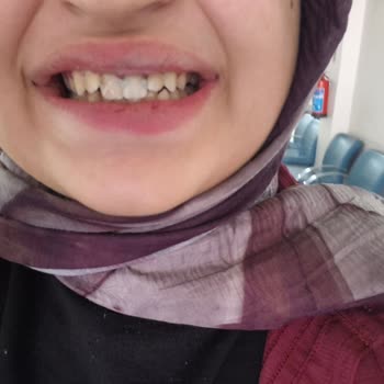 Mamak Ağız Ve Diş Hastanesinde Tedavi Sürecinin Aksaklığı Ve Yetersiz Ağrı Yönetimi