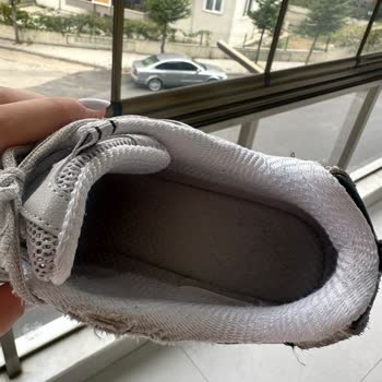 Skechers Ayakkabısının Kısa Sürede İç Kısmında Soyulma Ve Deformasyon Sorunu