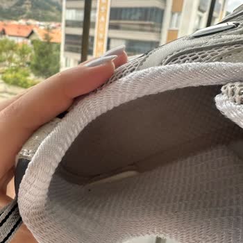 Skechers Ayakkabısının Kısa Sürede İç Kısmında Soyulma Ve Deformasyon Sorunu