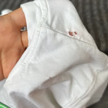 BİM Stop Leke Çıkarıcı Tişörtü Yırtarak Kullanılamaz Hale Getirdi