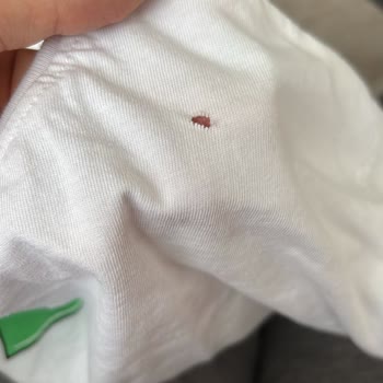 BİM Stop Leke Çıkarıcı Tişörtü Yırtarak Kullanılamaz Hale Getirdi