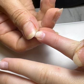Juno Nail'de Protez Tırnak İşlemi Sonrası Şiddetli Tırnak Hasarı Ve Ücret İadesi Talebi