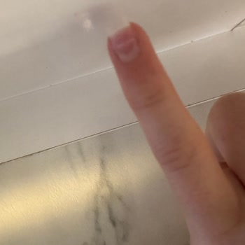 Juno Nail'de Protez Tırnak İşlemi Sonrası Şiddetli Tırnak Hasarı Ve Ücret İadesi Talebi