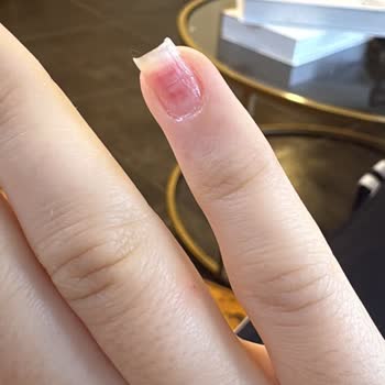 Juno Nail'de Protez Tırnak İşlemi Sonrası Şiddetli Tırnak Hasarı Ve Ücret İadesi Talebi