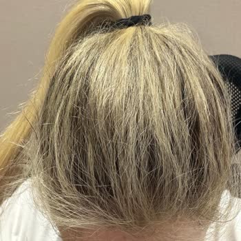Hair Chefs Saçım Bebek Sarısı Tonlarında Olması Gerekirken Grili Yeşil Bir Tona Döndü