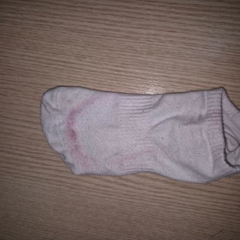Bordo Lekeli Adidas Ayakkabıda İlk Kullanımda Kalite Şikayeti
