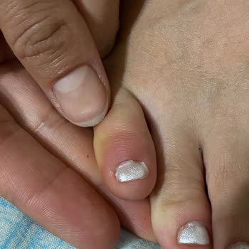 Kalıcı Oje Ve Pedikürde Kalitesiz İşçilik Ve Kaba Müşteri Tutumu İade Talebi