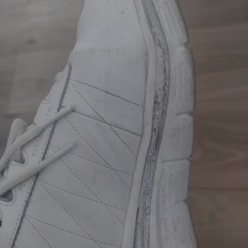 Üç Ayda Skechers Ayakkabısında Çatlak Ve Renk Atması, İade Talebi Reddedildi