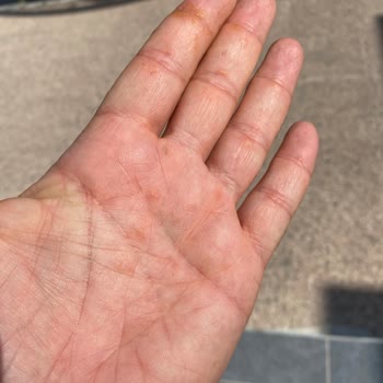 Aynı Doktorla Tekrarlanan Yetersiz Ve İlgisiz Muayene