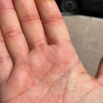 Aynı Doktorla Tekrarlanan Yetersiz Ve İlgisiz Muayene