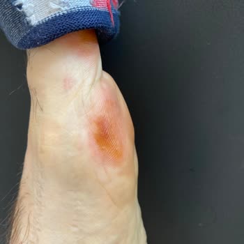 Aynı Doktorla Tekrarlanan Yetersiz Ve İlgisiz Muayene