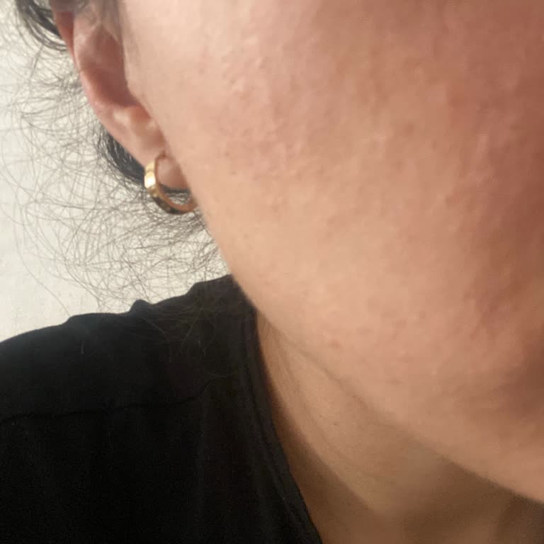 Cream Co Tester Güneş Kremi Yüzümde Şiddetli Yanma Ve Kabarıklıklara Neden Oldu