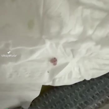 Sleepy Bebek Bezi Kurtlu Çıktı