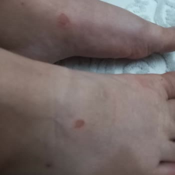 Greyder Terliği Ayağımı Yara İçinde Bıraktı, İade Talebim Reddedildi