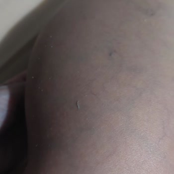 Neutrogena Nemlendirici Kremde Ciltte Soyulma Ve Yapışkanlık Şikayeti
