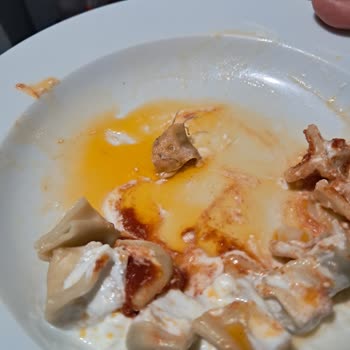 Dondurulmuş Mantı Ürününde Yara Bandı Bulunması Ve Markanın Sessizliği
