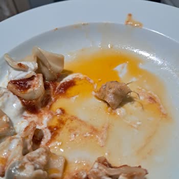 Dondurulmuş Mantı Ürününde Yara Bandı Bulunması Ve Markanın Sessizliği