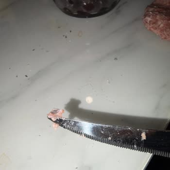 Köfte İçindeki Siyah Yabancı Madde Ve Hijyen Sorunu