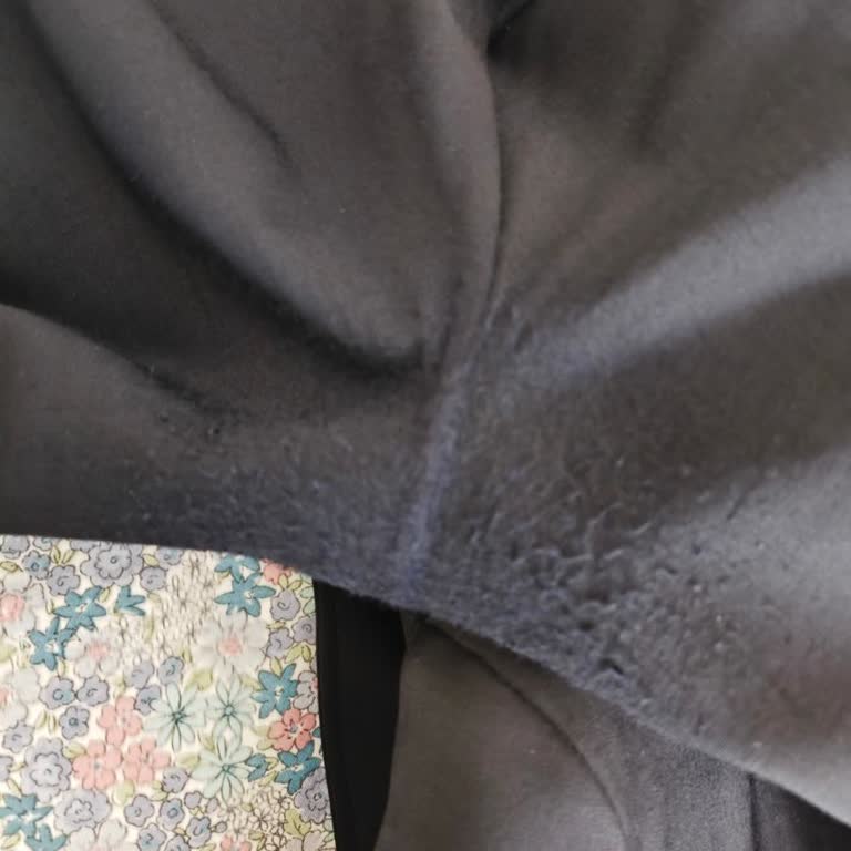 Hatemoğlu Eskişehir Takım Elbisesinde Kısa Sürede Pilling Ve Çözüm Talebi