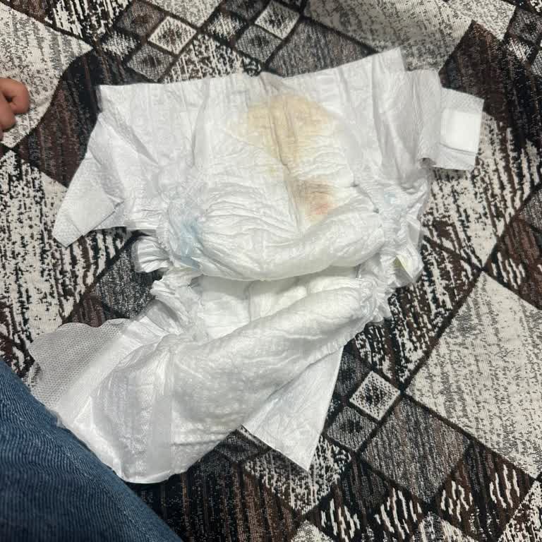 Molfix Bebek Bezlerinde Kahverengi Kuru Parça Sorunu Ve Hijyen Şikayeti