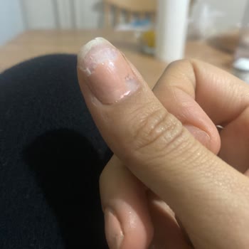 Salon Büşra Topuz Kalın Protez Tabakası Bırakılması Ve Ağrılı Tırnak Sorunu