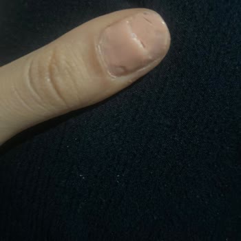 Salon Büşra Topuz Kalın Protez Tabakası Bırakılması Ve Ağrılı Tırnak Sorunu