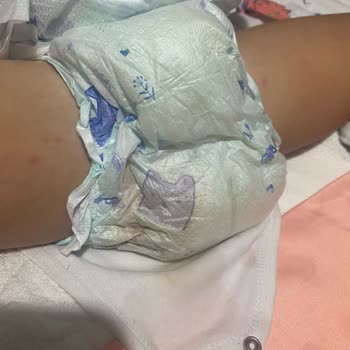 Poffy 6 Numara Bebek Bezinde Sürekli Taşırma Sorunu Ve İade İsteği