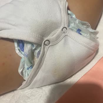 Poffy 6 Numara Bebek Bezinde Sürekli Taşırma Sorunu Ve İade İsteği