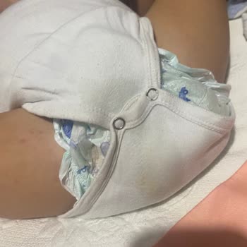 Poffy 6 Numara Bebek Bezinde Sürekli Taşırma Sorunu Ve İade İsteği