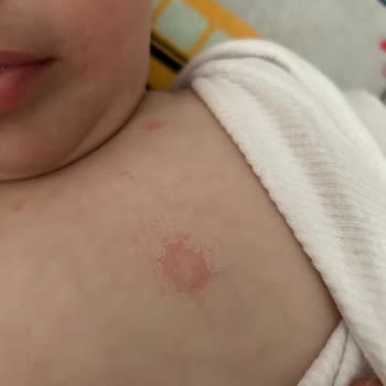 İva Natura Şampuanı Çocuğumda Cilt Alerjisi Ve Satıcıdan Cevap Yok