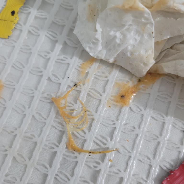 Siparişte Tavuk Tüyü Çıktı, Müşteri Hizmeti Çözüm Sunmadı