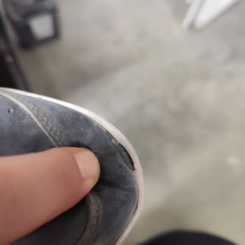 Adidas Ayakkabıda Deri Yırtılması Ve Garanti Reddi
