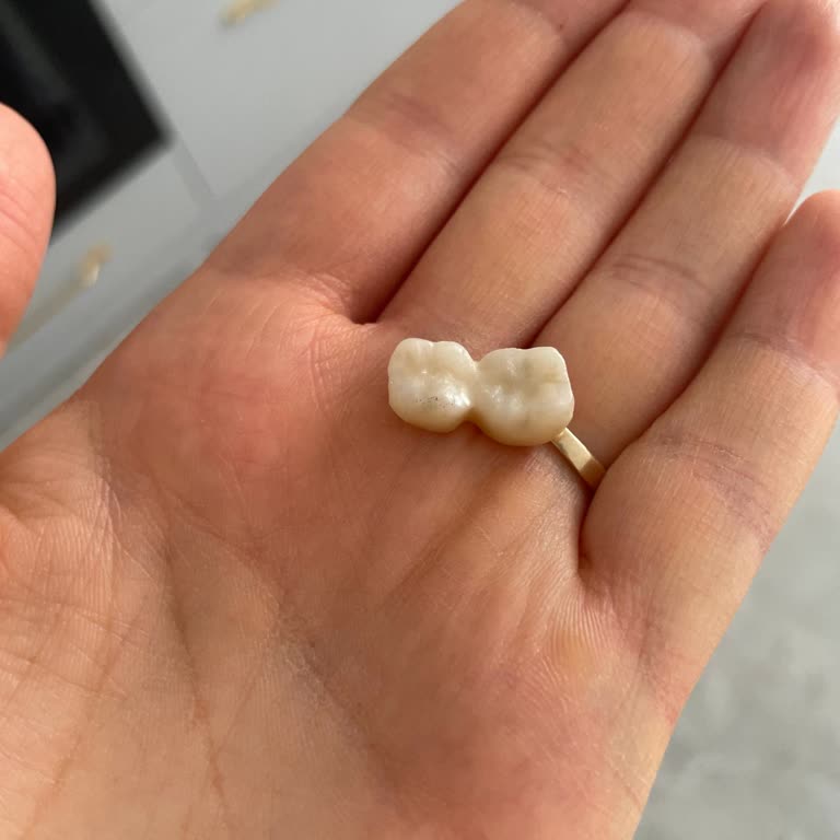 Dentasay'dan Garanti Kapsamındaki Zirkonyum Diş İçin Başka Şehirde Servis Sağlanamaması