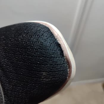 Kısa Sürede Açılan Skechers Ayakkabısının Garanti Reddi