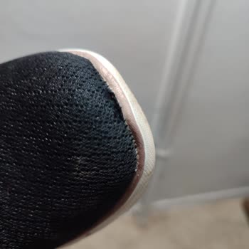 Kısa Sürede Açılan Skechers Ayakkabısının Garanti Reddi