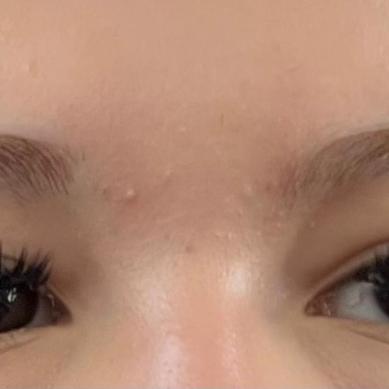 Fanes Nail Bar 1000 TL'lik İpek Kirpik İşleminde Model Uygulanamaması Ve Kalitesiz Sonuç