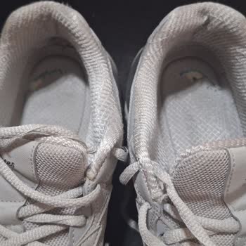 Skechers Ayakkabısının Topuk İç Astarı 4 Ayda Parçalandı, İade Talebi