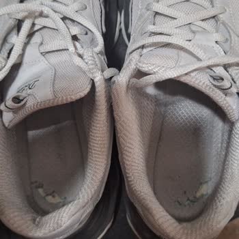 Skechers Ayakkabısının Topuk İç Astarı 4 Ayda Parçalandı, İade Talebi