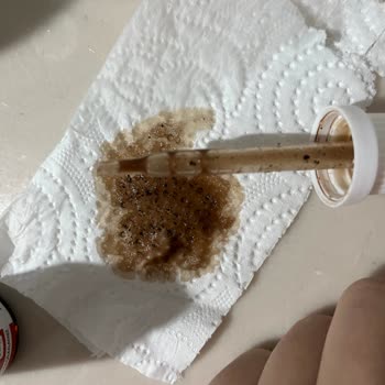 Bebek İçin Bozuk Şişe: Sağlık Riski Ve Ücret İadesi Talebi