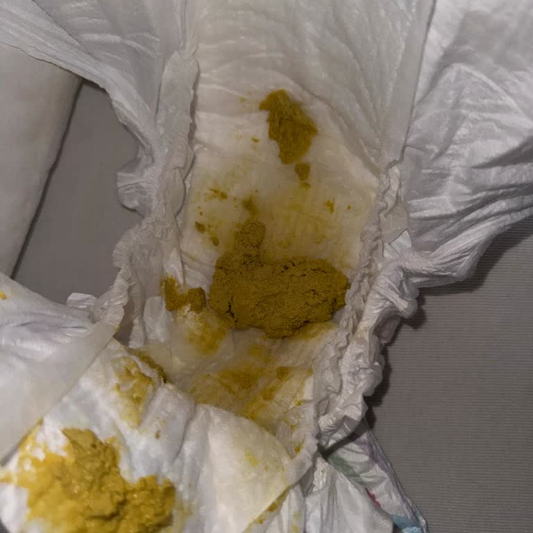 Aptamil Prosyneo Son Kutularda Bebekte Şiddetli Kabızlık Ve Gaz Sorunu