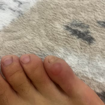 Boyner Mağazasında Yanıltıcı Bilgi Ve Ayakkabı Yaralanması Sonrası İade Reddi