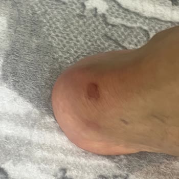 Boyner Mağazasında Yanıltıcı Bilgi Ve Ayakkabı Yaralanması Sonrası İade Reddi