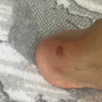 Boyner Mağazasında Yanıltıcı Bilgi Ve Ayakkabı Yaralanması Sonrası İade Reddi