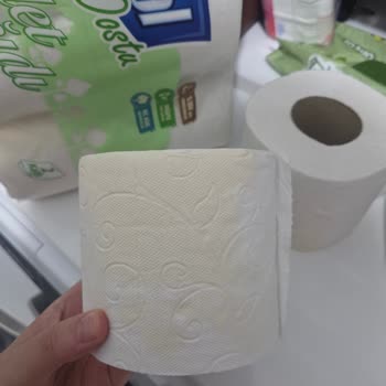 Sarı Lekeli Tuvalet Kağıdı Ve Cevapsız Müşteri Desteği