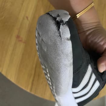 Adidas Çocuk Ayakkabısının 12 Gün İçinde Parçalanması Ve Mağazanın İade Reddi